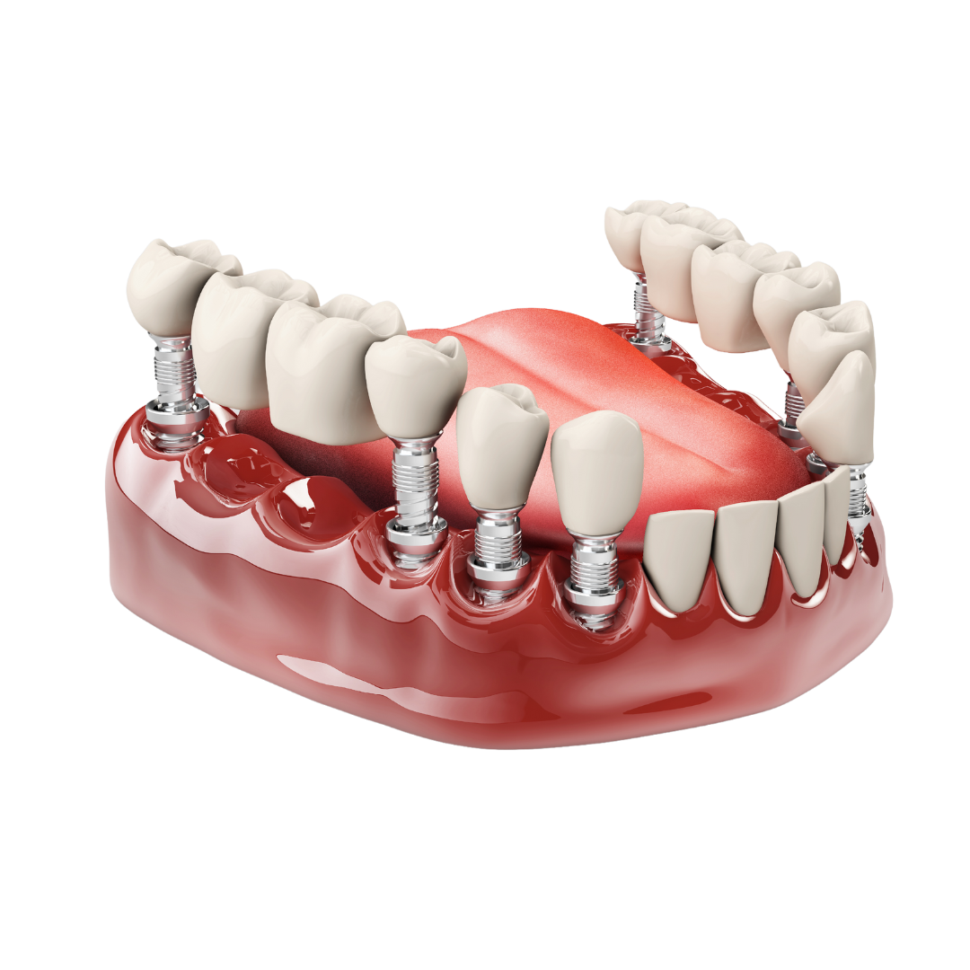 Dr. David Zelby | Prosthodontist Marietta, GA | Cosmetic Dentist